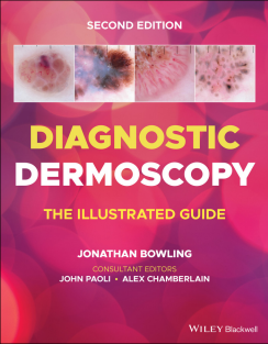 Diagnostic Dermoscopy The Illustrated Guide 2nd Edition