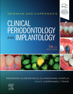 Newman and Carranza's Clinical Periodontology and Implantology 14th