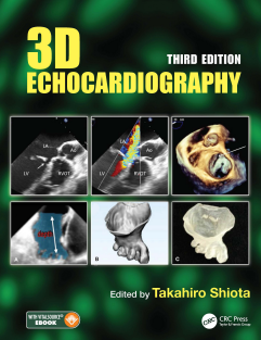 3D Echocardiography 3rd Edition