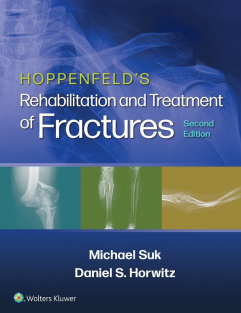 Hoppenfeld's Treatment and Rehabilitation of Fractures Second Edition