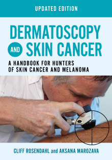 Dermatoscopy and Skin Cancer