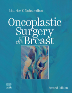 Oncoplastic Surgery of the Breast 2nd Edition