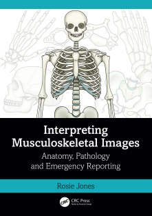 Interpreting Musculoskeletal Images
