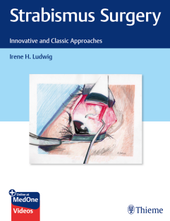 Strabismus Surgery Innovative and Classic Approaches