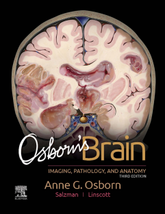 Osborn's Brain 3rd Edition