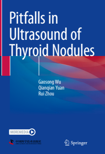 Pitfalls in Ultrasound of Thyroid Nodules