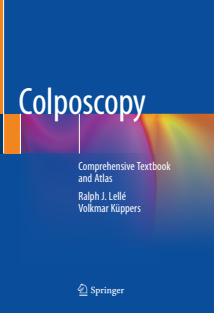 Colposcopy Comprehensive Textbook and Atlas 2023