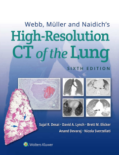 Webb, Müller and Naidich's High Resolution CT of the Lung 6th 2021