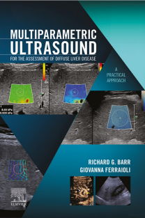 Multiparametric Ultrasound for the Assessment of Diffuse Liver Disease A Practical Approach