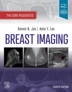 Breast Imaging The Core Requisites 4th Edition