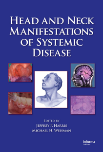 Head and Neck Manifestations of Systemic Disease Jeffrey P Harris