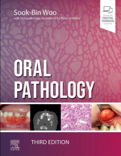 Oral Pathology 3rd Edition