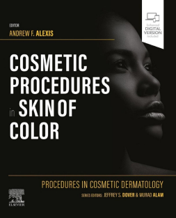 Procedures in Cosmetic Dermatology Cosmetic Procedures in Skin of Color