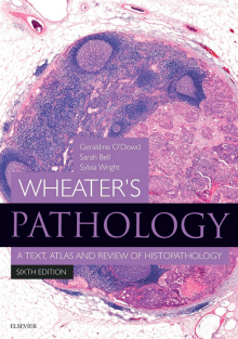 Wheater's Pathology A Text, Atlas and Review of Histopathology 6th Edition