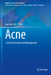 Acne  Current Concepts and Management