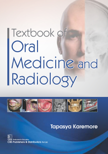 Textbook of Oral Medicine & Radiology
