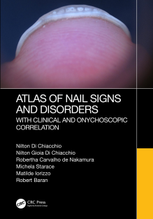 Atlas of Nail Signs and Disorders with Clinical and Onychoscopic Correlation