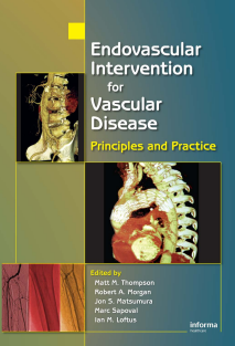 Endovascular Intervention for Vascular Disease Principles and Practice