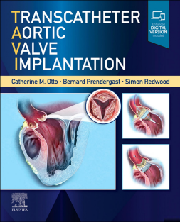 Transcatheter Aortic Valve Implantation 2022