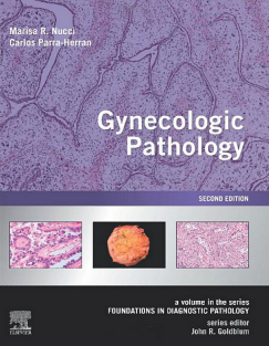 Gynecologic Pathology A Volume in Foundations in Diagnostic Pathology Series 2nd Edition