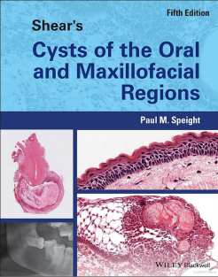 Shear's Cysts of the Oral and Maxillofacial Regions 5th Edition