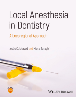 Local Anesthesia in Dentistry A Locoregional Approach