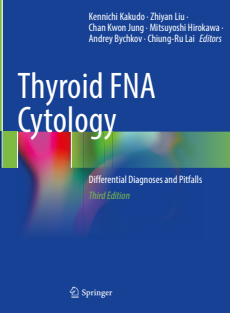 Thyroid FNA Cytology Differential Diagnoses and Pitfalls 3rd Edition