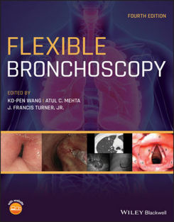 Flexible Bronchoscopy Wang Mehta Atul C Turner J Francis Wiley Blackwell