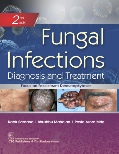 Fungal Infections Diagnosis and Treatment 2022