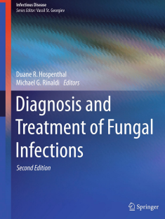 Diagnosis and Treatment of Fungal Infections