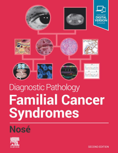 Diagnostic Pathology Familial Cancer Syndromes 2nd Edition