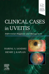 Clinical Cases in Uveitis Differential Diagnosis and Management