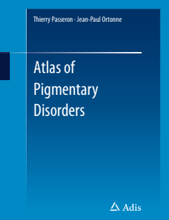 Atlas of Pigmentary Disorders