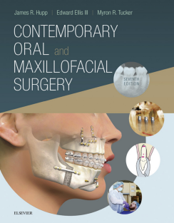 Contemporary Oral and Maxillofacial Surgery