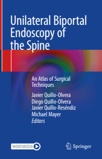 Unilateral Biportal Endoscopy of the Spine An Atlas of Surgical Techniques 2023