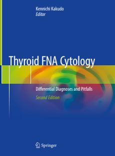 Thyroid FNA Cytology Differential Diagnoses and Pitfalls -2019 - Kennichi Kakudo