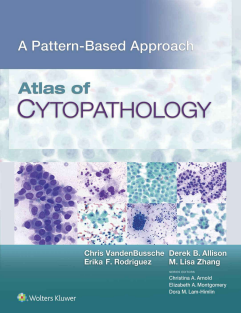 Atlas of Cytopathology A Pattern Based Approach 1st Edition