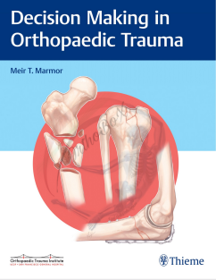 Decision Making in Orthopaedic Trauma