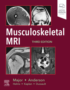 Musculoskeletal MRI 3rd Edition