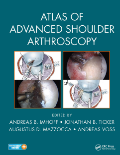 Atlas of Advanced Shoulder Arthroscopy 1st Edition