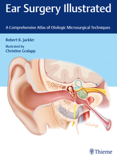 Ear Surgery Illustrated A Comprehensive Atlas of Otologic Microsurgical Techniques