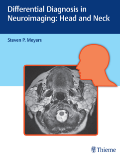 Differential Diagnosis in Neuroimaging Head and Neck 1st Edition