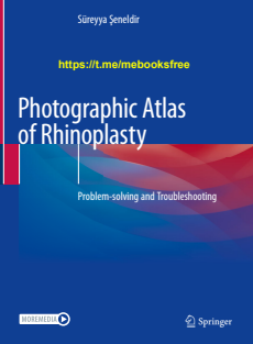 Photographic Atlas of Rhinoplasty Problem-solving and Troubleshooting 2021