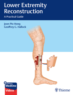 Lower Extremity Reconstruction A Practical Guide, 1e