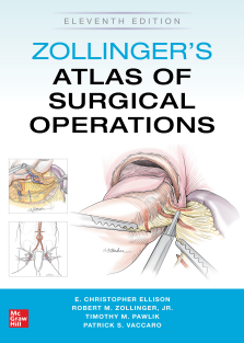 Zollinger's Atlas of Surgical Operations, Eleventh Edition