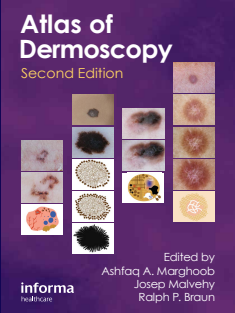 Atlas of dermoscopy