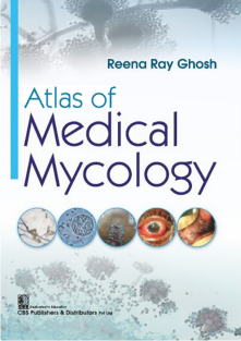 Atlas of Medical Mycology