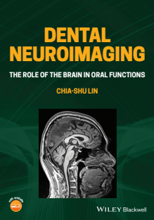 Dental Neuroimaging The Role of the Brain in Oral Functions 2022