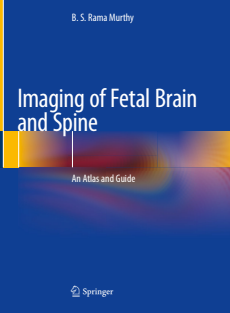 Imaging of Fetal Brain and Spine An Atlas and Guide