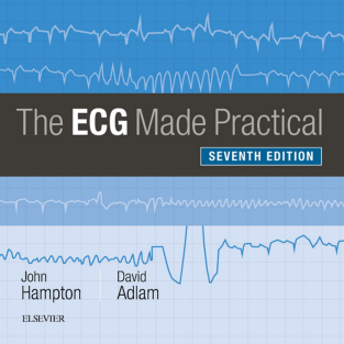 The ECG Made Practical 7th